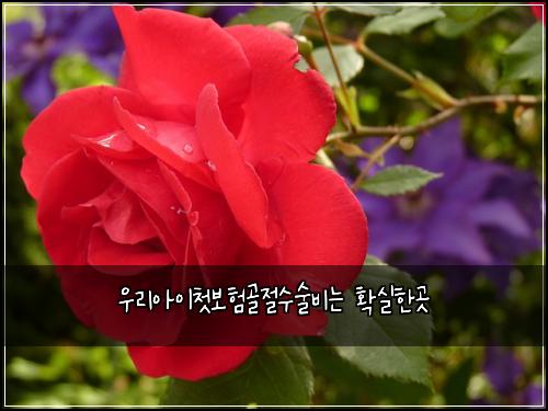 ์ฐ๋ฆฌ์์ด์ฒซ๋ณดํ๊ณจ์ ์์ ๋น๋ ํ์คํ๊ณณ